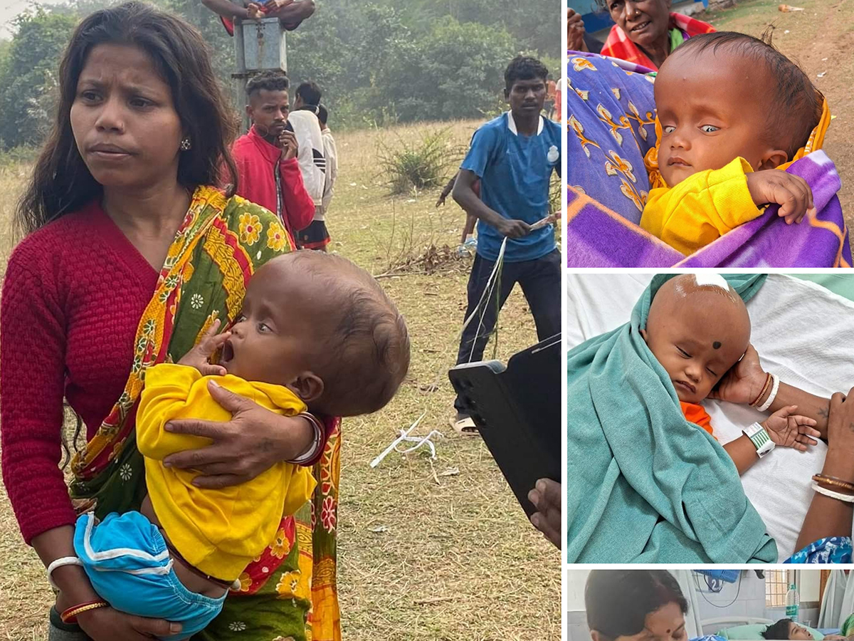 Mathur’s Treatment Suffering from Hydrocephalus